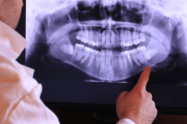 Best Emergency Dentist for Knocked-Out Tooth in Jamestown, NY