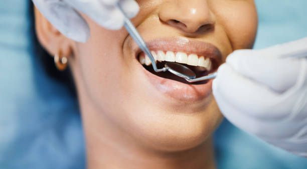 Best Emergency Cosmetic Dentistry in Jamestown, NY