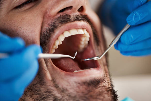 Best Emergency Dental Services for Seniors in Jamestown, NY
