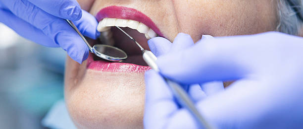 Best Emergency Root Canal Treatment in Jamestown, NY